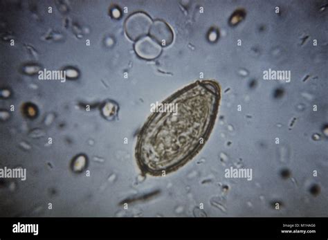  Clonorchis Sinensis:  The Tiny Trematode That Makes Your Liver Its Home!